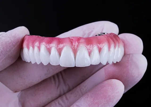 Prótese sobre Implantes