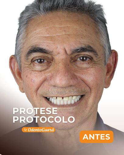 Antes