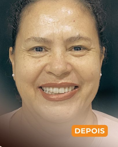 Depois