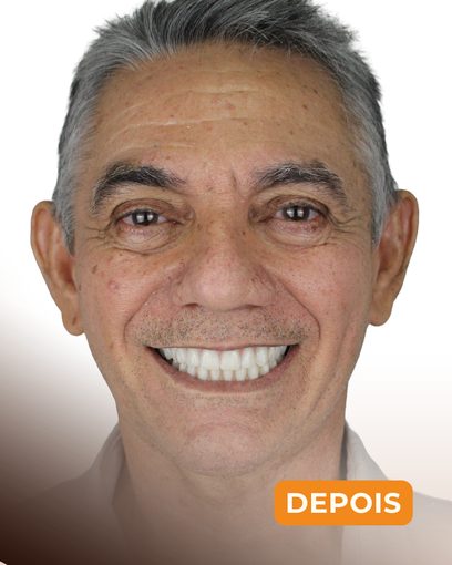Depois