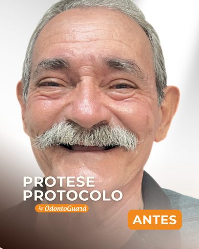 Antes