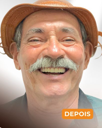 Depois