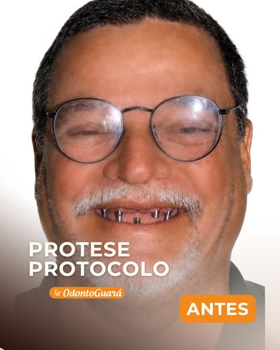 Antes
