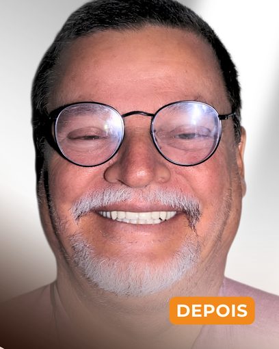 Depois