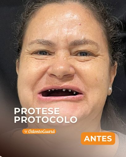 Antes